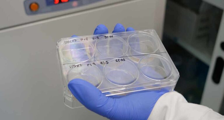 Universidad de Alicante desarrolla aplicaciones clínicas de espectrometría de masas para detectar enfermedades en etapas tempranas